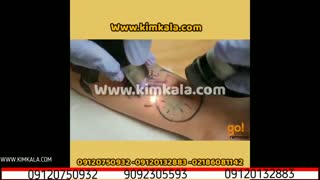 دستگاه تتو لیزر q-switch | بهترین روش لیزر تتو | 09120750932 | پاک کردن قطعی تتو | از بین بردن تتو ابرو | قیمت لیزر تتو در تهران