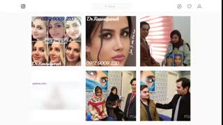 تیزر تبلیغات اینستاگرام دکتر حسین رسول پناه جراح بینی