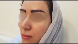 شیوه جدید کاشت ابرو