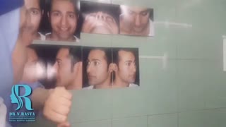 جراحی زیبایی بینی در اتاق عمل