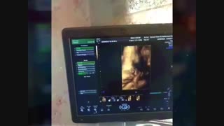 فیلم زایمان