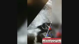 سونوگرافی کالرداپلر بند ناف جنین