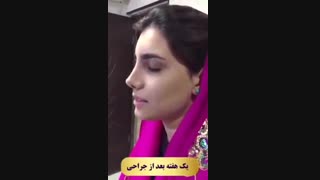 رضایت بیمار از تیپ پلاستی