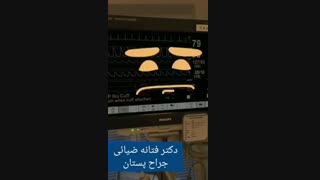 فیلم قابل تامل و بسیار پربازدید
