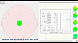 لورتا نوروفیدبک Loreta Neurofeedback