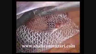 جراحی لاپاروسکوپیک هرنی کشاله ران