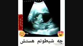 جنین شیطون