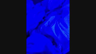 ترکیب تکنولوژی CESو اتاق تاریک در کودکان اوتیسم و بیش فعال