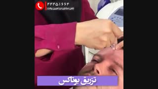 تزریق بوتاکس برداشتن توده