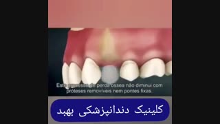 فیلم درمان شکستگی دندان