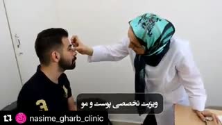 کلینیک زیبایی پیلینگ شیمیایی