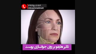 هایفو کلینیک پوست