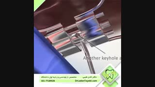 دستگاه وسیع کننده کام | دکتر لادن طیبی