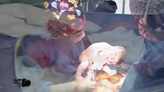 فیلم زایمان سزارین