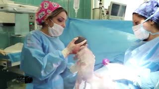 عمل جراحی سزارین