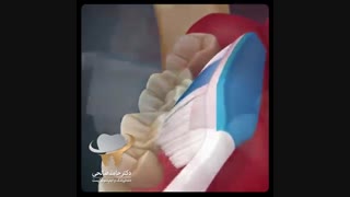 ضرورت صحیح مسواک زدن | دکتر حامد صالحی برداشتن خال