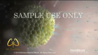 عمل وازکتومی چیست؟