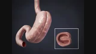 انیمیشن فیلم پلیسه معده (پلیکاسیون معده)