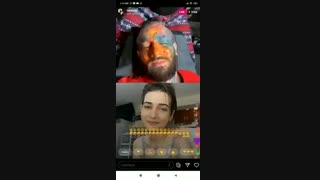 ندا تزریق بوتاکس