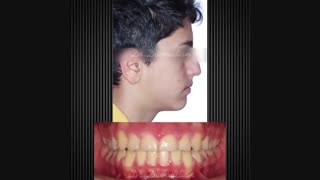 ارتودنسی و ارتوپدی فک | دکتر داودیان