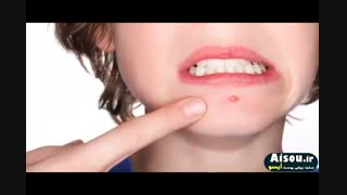 فواید اعجاب انگیز صابون زردچوبه آیسو روی پوست صورت