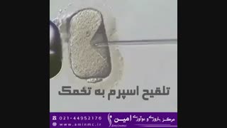 روش کمک باروری میکرواینجکشن