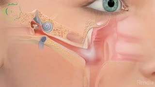 عفونت گوش میانی