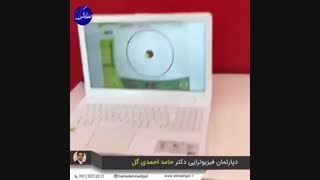 فیزیوتراپی تعویض مفصل زانو، ۰۹۱۲۸۳۳۲۸۲۱