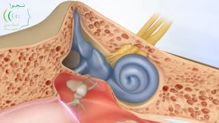 کم شنوایی حسی عصبی