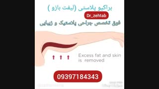 فیلم جراحی لیفت بازو ( براکیوپلاستی) کشیدن دندان