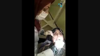 نمونه کار عصب کشی سه کاناله