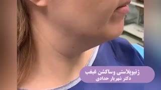 ژنیوپلاستی و ساکشن غبغب