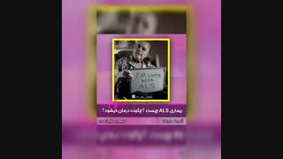 جراحی تنگی شدید کانال کمری و اسکولیوز دژنراتیو